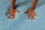 The open-cell Visco Memory Foam with Gel-infused Polymers is proven to reduce the occurrence of pressure sores by channeling heat away from the body significantly faster than traditional foam.