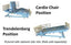 Big Boyz Low Bed 800 shown in Cardio Chair and Trendelenberg positions.